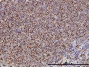 Anti-ADD1 Mouse Monoclonal Antibody [clone: 2C9]