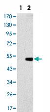 Anti-GCK Mouse Monoclonal Antibody [clone: 4G6]