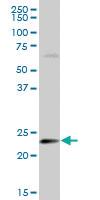 Anti-HSPB8 Mouse Polyclonal Antibody