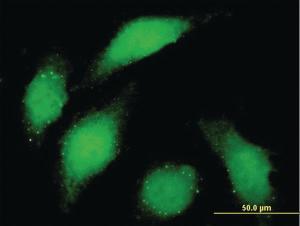 Anti-BUB1 Mouse Monoclonal Antibody [clone: 4C3-4C9]