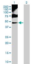 Anti-ENO1 Rabbit Polyclonal Antibody