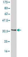 Anti-SLC2A4 Mouse Monoclonal Antibody [clone: 2D6]