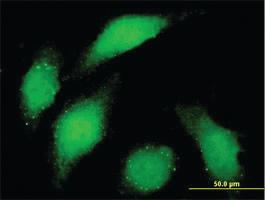 Anti-BUB1 Mouse Monoclonal Antibody [clone: 4C3-4C9]