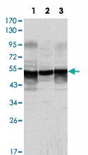 Anti-GFAP Mouse Monoclonal Antibody [clone: 6A6]