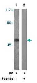 Anti-TP53 Rabbit Polyclonal Antibody