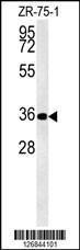 Anti-DPF3 Rabbit Polyclonal Antibody (HRP (Horseradish Peroxidase))