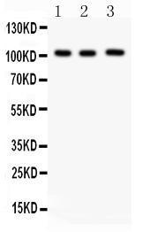 Anti-ITCH/AIP4 Rabbit Polyclonal Antibody