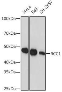 Western blot analysis of extracts of various cell lines, using Anti-RCC1 Antibody [ARC1834] (A307816) at 1:1,000 dilution The secondary antibody was Goat Anti-Rabbit IgG H&L Antibody (HRP) at 1:10,000 dilution Lysates/proteins were present at 25 µg per lane