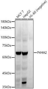 Western blot analysis of various lysates, using Anti-P4HA2 Antibody [ARC54912] (A306134) at 1:20,000 dilution