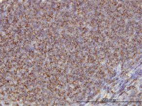 Anti-ADD1 Mouse Monoclonal Antibody [clone: 2C9]