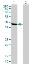 Anti-ENO1 Mouse Monoclonal Antibody [clone: 8G8]