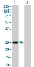 Anti-HSPB8 Mouse Monoclonal Antibody [clone: 5D7]