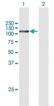 Anti-CMTR1 Mouse Polyclonal Antibody