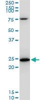 Anti-TPT1 Mouse Monoclonal Antibody [clone: 2A3]