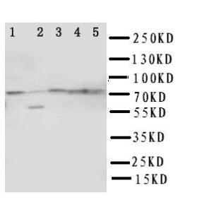 Anti-ABCG1 Rabbit Polyclonal Antibody