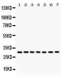 Anti-NQO1 Rabbit Polyclonal Antibody