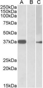 HEK293 lysate (10ug protein in RIPA buffer) overexpressing Human MYF6 with MYC tag probed