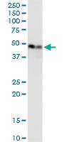 Anti-ENO1 Mouse Monoclonal Antibody [clone: 8G8]