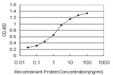 Anti-HSPB8 Mouse Monoclonal Antibody [clone: 5D7]