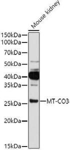 Western blot analysis of extracts of Mouse kidney, using Anti-Complex IV Antibody (A92884) at 1:1000 dilution. The secondary Antibody was Goat Anti-Rabbit IgG H&L Antibody (HRP) at 1:10000 dilution. Lysates/proteins were present at 25 µg per lane.s