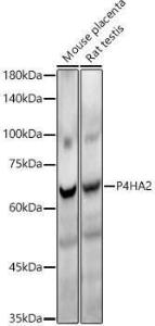 Western blot analysis of various lysates, using Anti-P4HA2 Antibody [ARC54912] (A306134) at 1:20,000 dilution