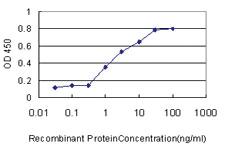 Anti-ADD1 Mouse Monoclonal Antibody [clone: 2C9]