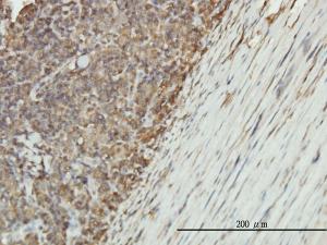 Anti-ENO1 Mouse Monoclonal Antibody [clone: 8G8]