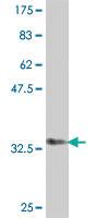 Anti-DSTN Mouse Polyclonal Antibody