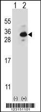 Anti-CLTB Rabbit Polyclonal Antibody (AP (Alkaline Phosphatase))