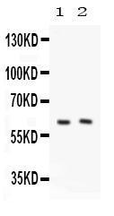 Anti-PKLR Rabbit Polyclonal Antibody