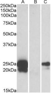 HEK293 lysate (10ug protein in RIPA buffer) overexpressing Human WFDC2 with C-terminal MYC tag probed with Anti-WFDC2 Antibody (A84804) (1µg/ml) in Lane A and probed with anti-MYC Tag (1/1000) in lane C