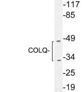 Antibody anti-COLQ 100 µg