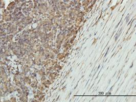 Anti-ENO1 Mouse Monoclonal Antibody [clone: 8G8]