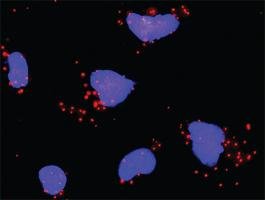 Anti-CDKN1A + SMAD4 Antibody Pair