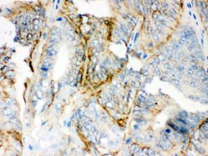 Anti-PKLR Rabbit Polyclonal Antibody