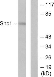 Antibody anti-SHC A96434-100 100 µg