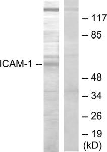 Western blot analysis of lysates from HepG2 cells using Anti-ICAM-1 Antibody. The right hand lane represents a negative control, where the antibody is blocked by the immunising peptide