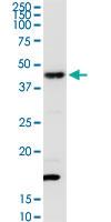 Anti-ERP44 Rabbit Polyclonal Antibody