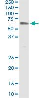 Anti-UGT1A9 Antibody Pair