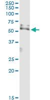 Anti-USP3 Polyclonal Antibody Pair