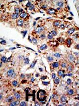 Anti-KMT4 Rabbit Polyclonal Antibody