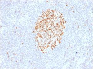 Immunohistochemical analysis of formalin-fixed, paraffin-embedded human lymph node using Anti-MSH6 Antibody [MSH6/2927]