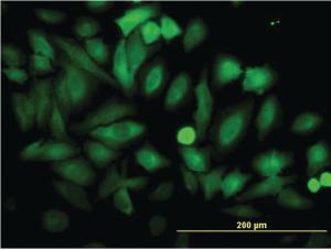 Anti-ENO1 Mouse Monoclonal Antibody [clone: 8G8]