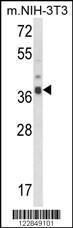 Anti-ARPC1B Rabbit Polyclonal Antibody (HRP (Horseradish Peroxidase))