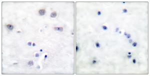 Antibody anti-SHC A96434-100 100 µg