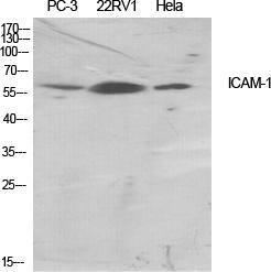 Western blot analysis of various cells using Anti-ICAM-1 Antibody