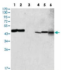 Anti-GOT2 Mouse Monoclonal Antibody [clone: 3E9]