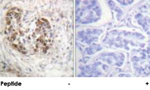 Anti-TP53 Rabbit Polyclonal Antibody