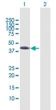 Anti-WNT5B Rabbit Polyclonal Antibody