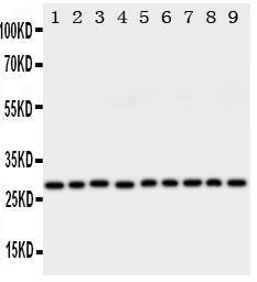 Anti-Peroxiredoxin 3 Rabbit Polyclonal Antibody